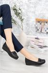 Orthopedic Pad Bow Black Shoes